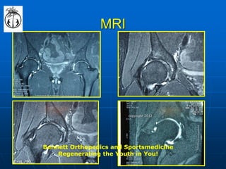 MRI 
Bennett Orthopedics and Sportsmedicine 
Regenerating the Youth in You! 
copyright 2012  