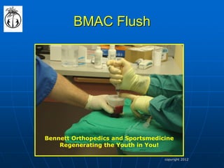 BMAC Flush 
Bennett Orthopedics and Sportsmedicine 
Regenerating the Youth in You! 
copyright 2012  