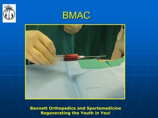 BMAC 
Bennett Orthopedics and Sportsmedicine 
Regenerating the Youth in You! 
copyright 2012  