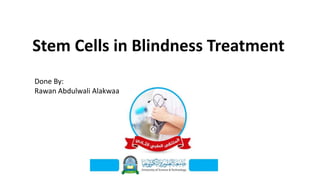 Stem Cells in Blindness Treatment
Done By:
Rawan Abdulwali Alakwaa
 