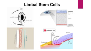 Stem Cells in Blindness Treatment | PPTX