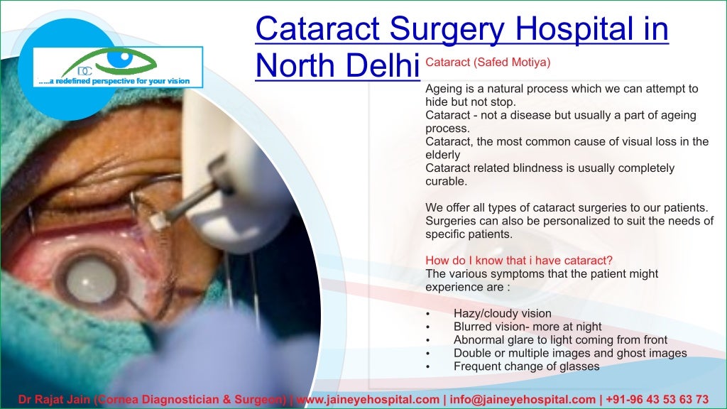 Stem cells in eye treatment north delhi, eye surgery in