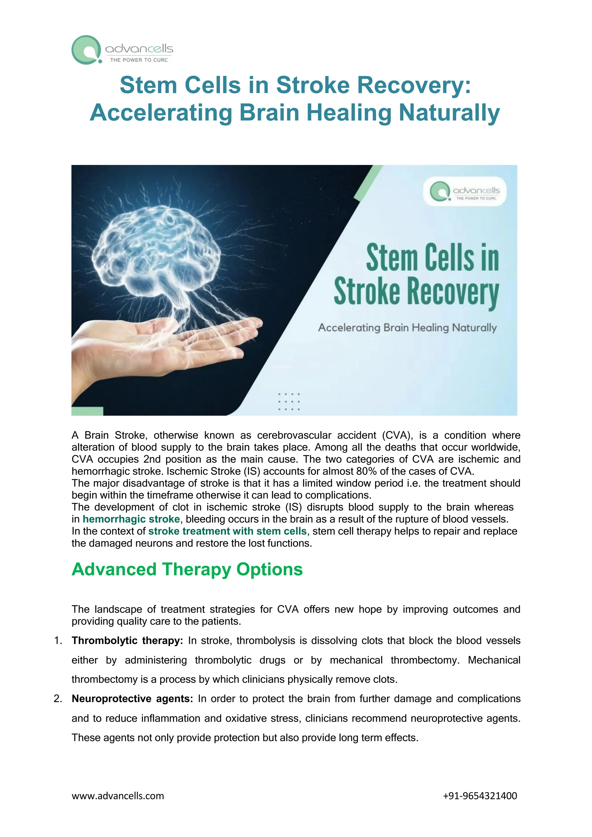 Stem Cells in Stroke Recovery: Accelerating Brain Healing Naturally | PDF