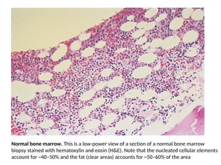 Normal Marrow Elements Comprehensive Overview of Stem Cells and Hematopoiesis in Medicine | PDF