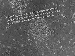 Understanding Stem Cells