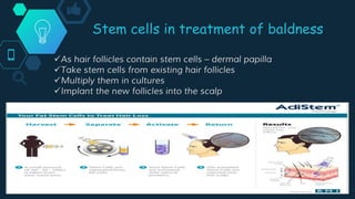 Stem cells in treatment of baldness
As hair follicles contain stem cells – dermal papilla
Take stem cells from existing hair follicles
Multiply them in cultures
Implant the new follicles into the scalp
 