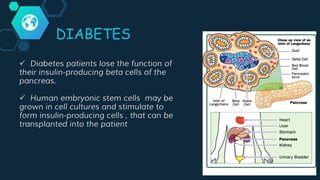 DIABETES
 Diabetes patients lose the function of
their insulin-producing beta cells of the
pancreas.
 Human embryonic stem cells may be
grown in cell cultures and stimulate to
form insulin-producing cells , that can be
transplanted into the patient
 