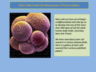 Stem Cells Under the Microscope: A Picture Gallery




                              Stem cells are how we all begin:
                              undifferentiated cells that go on
                              to develop into any of the more
                              than 200 types of cell the adult
                              human body holds. (Courtesy:
                              New York Times)

                              We have read about stem cell
                              research in various disease fields.
                              Here is a gallery of stem cells
                              sourced from various published
                              papers.
 