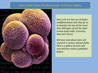 Stem Cells Under the Microscope: A Picture Gallery




                              Stem cells are how we all begin:
                              undifferentiated cells that go on
                              to develop into any of the more
                              than 200 types of cell the adult
                              human body holds. (Courtesy:
                              New York Times)

                              We have read about stem cell
                              research in various disease fields.
                              Here is a gallery of stem cells
                              sourced from various published
                              papers.
 
