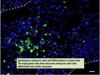 Spontaneous embryonic stem cellcell differentiation mouse cells.
    Spontaneous embryonic stem differentiation in in mouse
The bright green cells show that some embryonic stem cells
    cells. The bright green cells show that some embryonic
differentiate into cardiac myocytes. myocytes.
    stem cells differentiate into cardiac
 