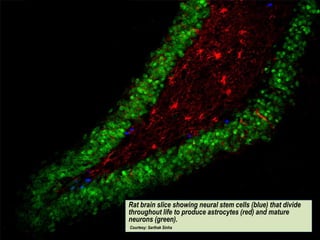 Rat brain slice showing neural stem cells (blue) that divide
throughout life to produce astrocytes (red) and mature
neurons (green).
Courtesy: Sarthak Sinha
 