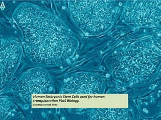 Human Embryonic Stem Cells used for human
transplantation PLoS Biology.
Courtesy: Sarthak Sinha
 