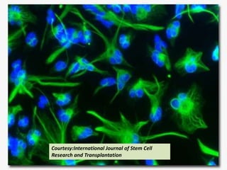 International Journal of Stem Cell Research and
Transplantation
  Courtesy:International Journal of Stem Cell
  Research and Transplantation
 