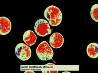 Human hematopoietic stem cells. Image courtesy:
Lancet,Oncology

 Human hematopoietic stem cells.
 Image courtesy: Lancet,Oncology
 