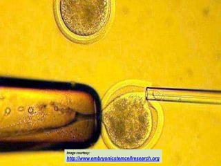 Image courtesy: http://www.embryonicstemcellresearch.org/

         Image courtesy:
         http://www.embryonicstemcellresearch.org
 