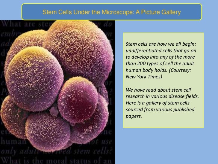 Stem Cells Under The Microscope A Picture Gallery