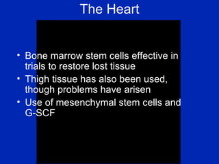 The Heart Bone marrow stem cells effective in trials to restore lost tissue Thigh tissue has also been used, though problems have arisen Use of mesenchymal stem cells and G-SCF 