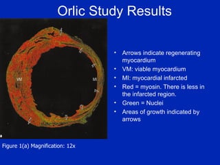 Orlic Study Results Arrows indicate regenerating myocardium VM: viable myocardium MI: myocardial infarcted Red = myosin. There is less in the infarcted region. Green = Nuclei Areas of growth indicated by arrows Figure 1(a) Magnification: 12x 