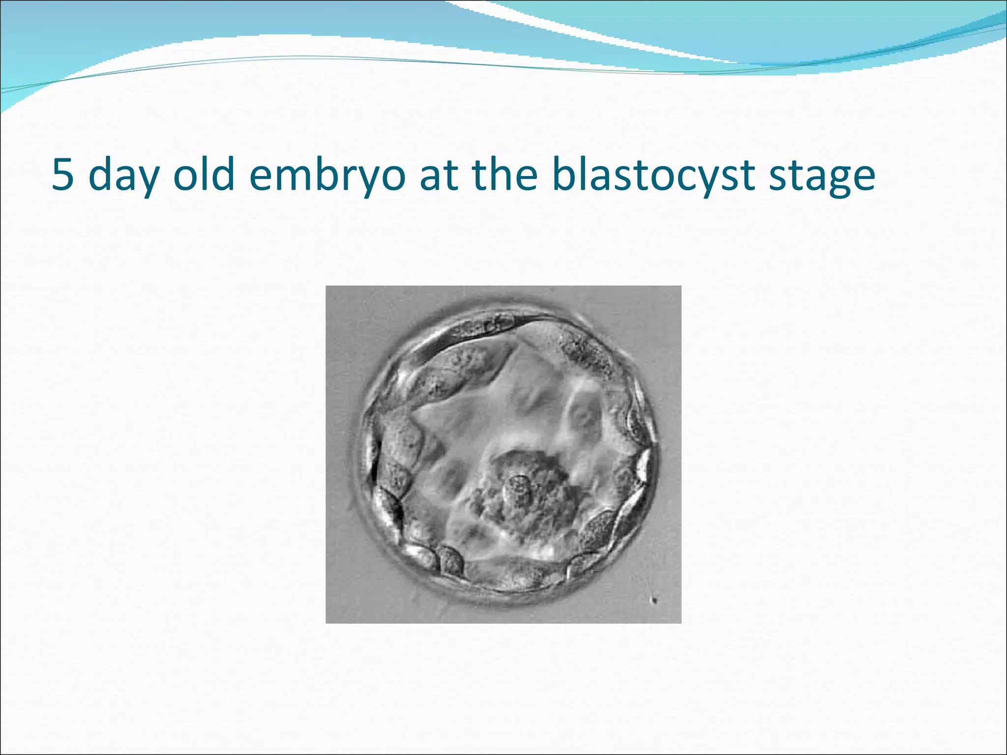 5 day old embryo at the blastocyst stage 