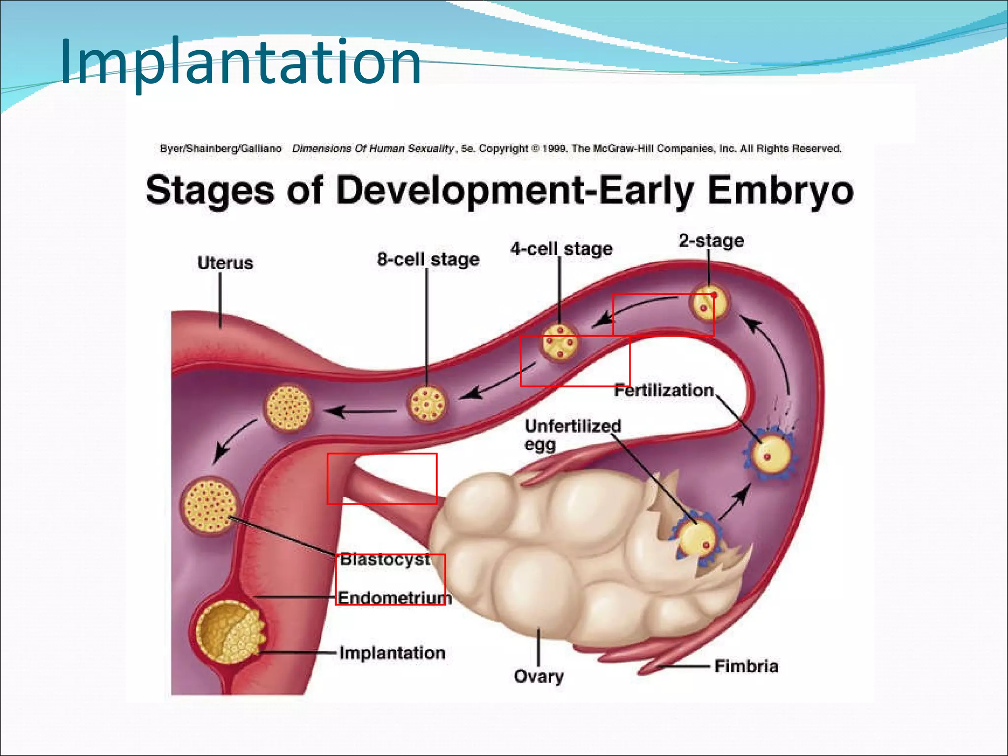 Implantation 