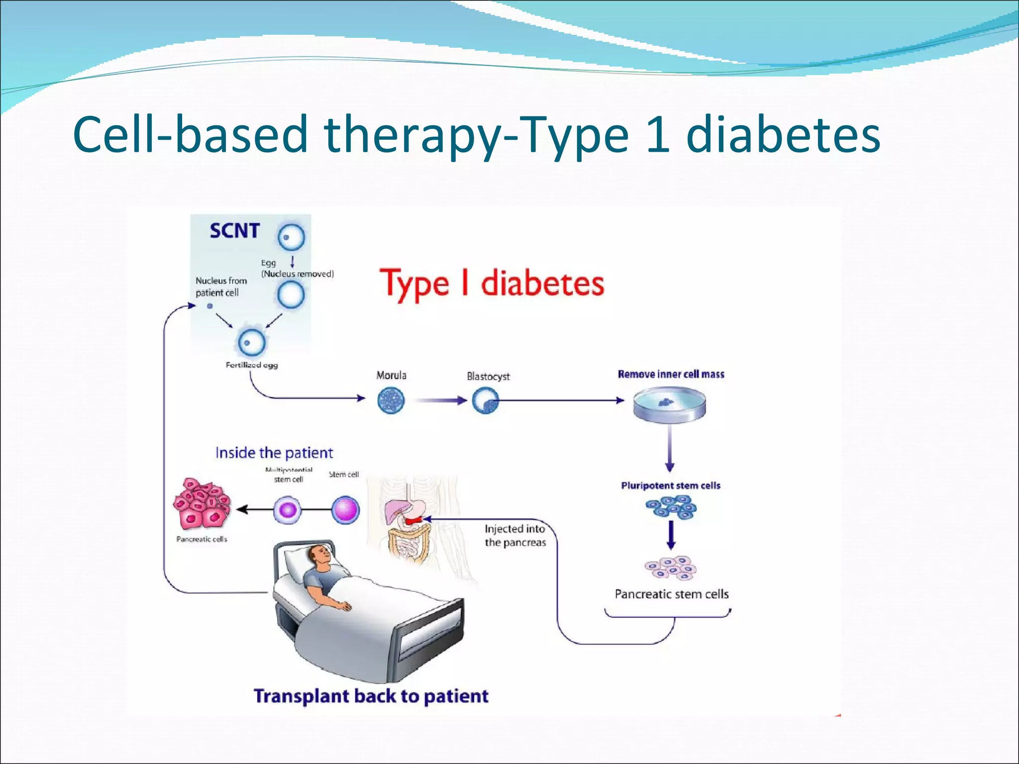 Cell-based therapy-Type 1 diabetes 