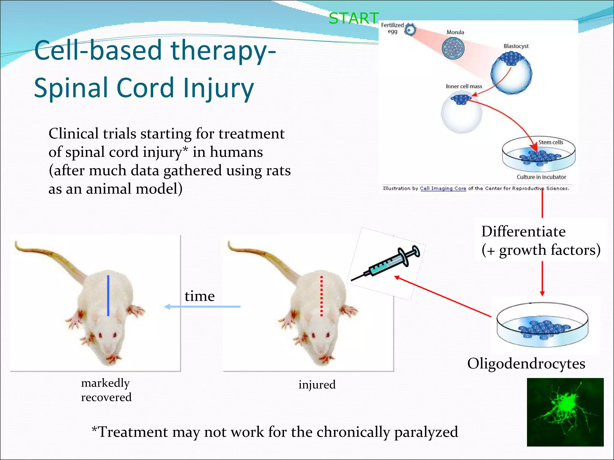 Cell-based therapy- Spinal Cord Injury Differentiate (+ growth factors) START *Treatment may not work for the chronically paralyzed time Oligodendrocytes Clinical trials starting for treatment  of spinal cord injury* in humans (after much data gathered using rats as an animal model) injured markedly recovered 