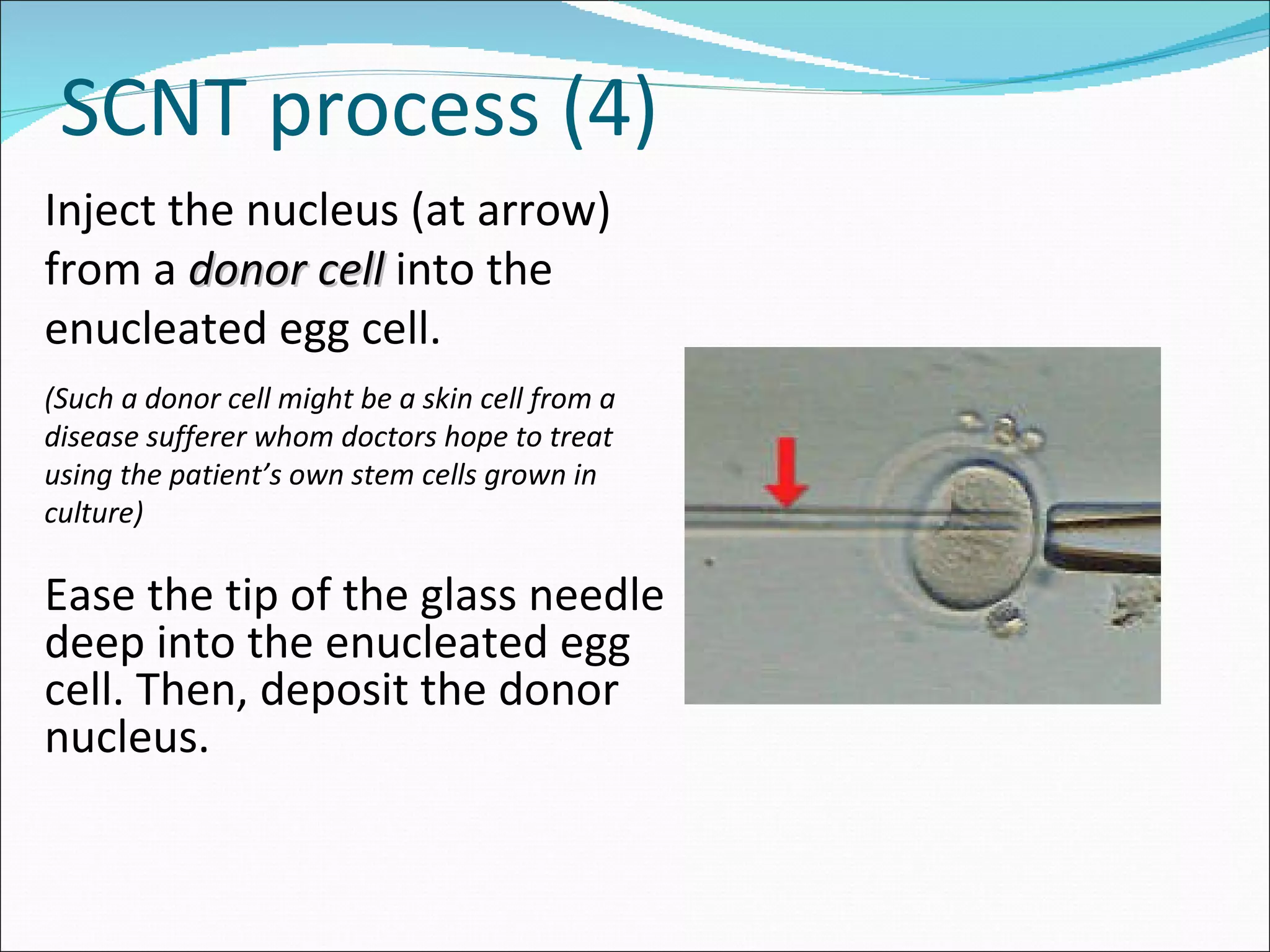 SCNT process (4) Ease the tip of the glass needle deep into the enucleated egg cell. Then, deposit the donor nucleus. Inject the nucleus (at arrow) from a  donor cell  into the enucleated egg cell.  (Such a donor cell might be a skin cell from a disease sufferer whom doctors hope to treat using the patient’s own stem cells grown in culture) 