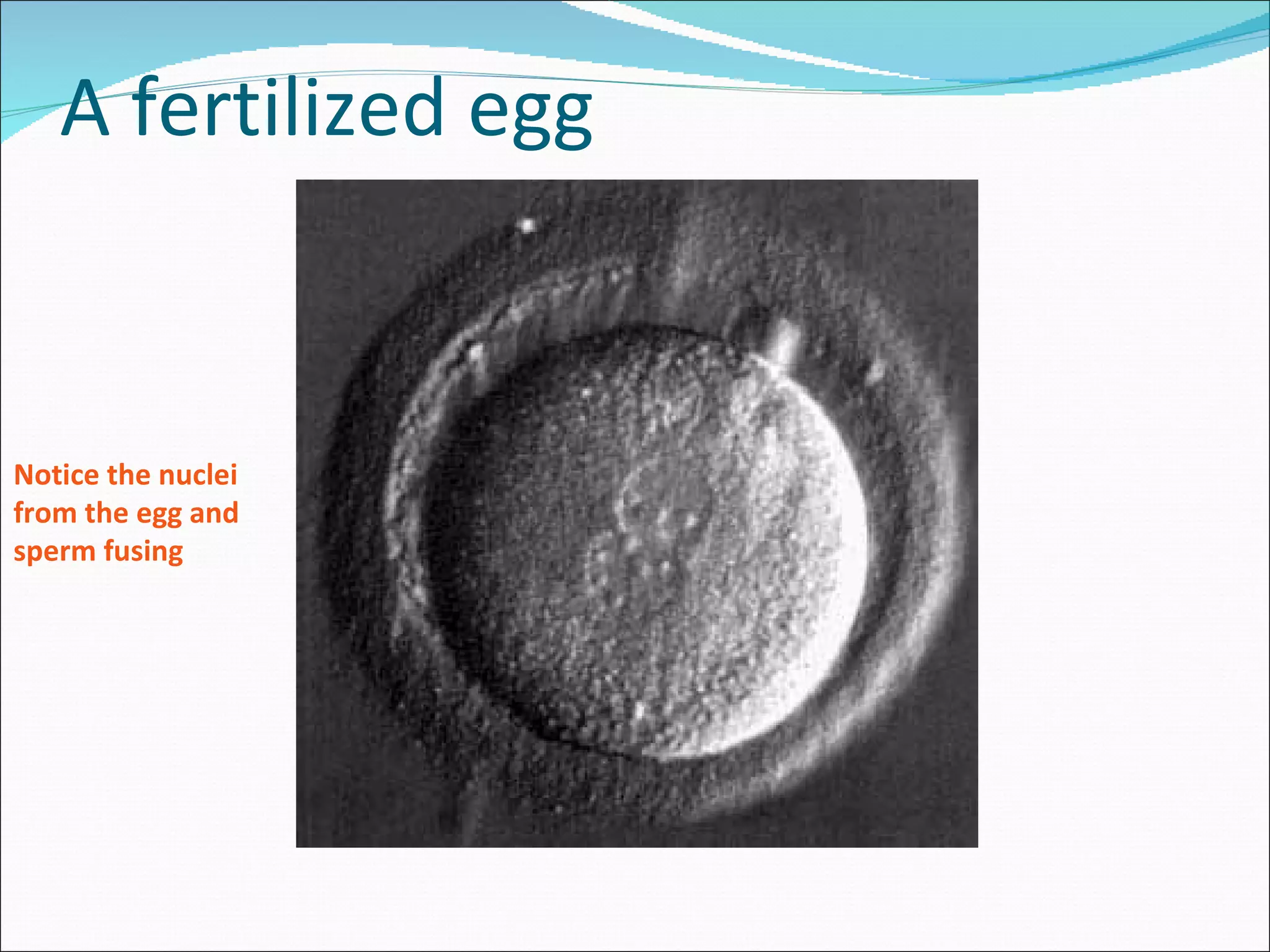 A fertilized egg Notice the nuclei  from the egg and  sperm fusing 