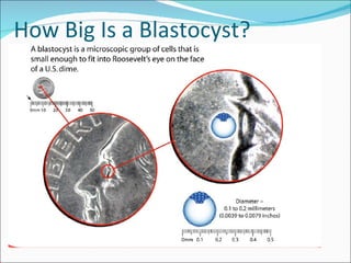 How Big Is a Blastocyst? 