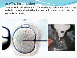 In vitro  fertilization Some procedures involved with IVF manually inject the sperm into the egg, and others simply allow fertilization to occur by adding the sperm to the egg in the lab setting.   