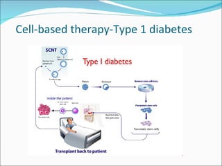 Cell-based therapy-Type 1 diabetes 