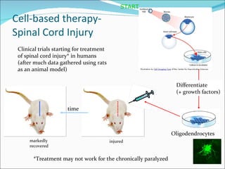 Cell-based therapy- Spinal Cord Injury Differentiate (+ growth factors) START *Treatment may not work for the chronically paralyzed time Oligodendrocytes Clinical trials starting for treatment  of spinal cord injury* in humans (after much data gathered using rats as an animal model) injured markedly recovered 