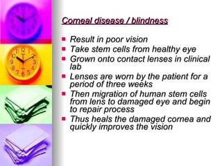 Corneal disease / blindness Result in poor vision Take stem cells from healthy eye Grown onto contact lenses in clinical lab Lenses are worn by the patient for a period of three weeks Then migration of human stem cells from lens to damaged eye and begin to repair process Thus heals the damaged cornea and quickly improves the vision  