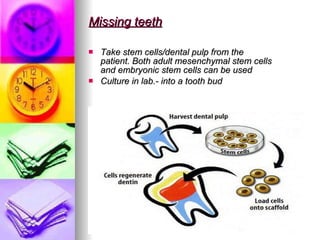 Missing teeth Take stem cells/dental pulp from the patient. Both adult mesenchymal stem cells and embryonic stem cells can be used Culture in lab.- into a tooth bud 