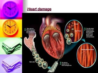 Heart damage 