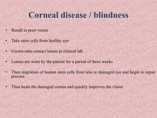 Corneal disease / blindness
• Result in poor vision
• Take stem cells from healthy eye
• Grown onto contact lenses in clinical lab
• Lenses are worn by the patient for a period of three weeks
• Then migration of human stem cells from lens to damaged eye and begin to repair
process
• Thus heals the damaged cornea and quickly improves the vision
 