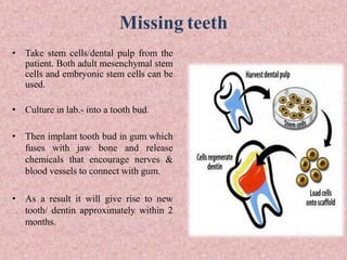 Missing teeth
• Take stem cells/dental pulp from the
patient. Both adult mesenchymal stem
cells and embryonic stem cells can be
used.
• Culture in lab.- into a tooth bud.
• Then implant tooth bud in gum which
fuses with jaw bone and release
chemicals that encourage nerves &
blood vessels to connect with gum.
• As a result it will give rise to new
tooth/ dentin approximately within 2
months.
 
