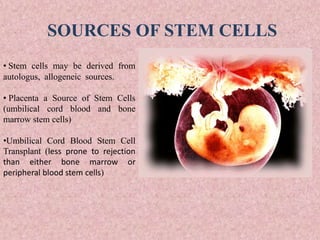 SOURCES OF STEM CELLS
• Stem cells may be derived from
autologus, allogeneic sources.
• Placenta a Source of Stem Cells
(umbilical cord blood and bone
marrow stem cells)
•Umbilical Cord Blood Stem Cell
Transplant (less prone to rejection
than either bone marrow or
peripheral blood stem cells)
 