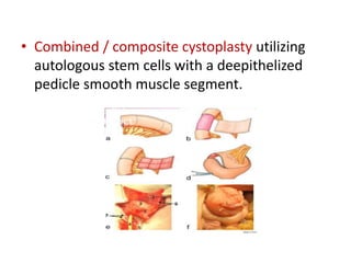 Stem cell therapy | PPTX