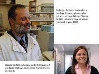 Professor Anthony Hollander, a
cartilage tissue engineer, who
cultured stem cells from Claudia
Castillo to build a new windpipe
(trachea) in year 2008
Claudia Castillo, who received a transplanted
windpipe that was engineered from her own
stem cells
 