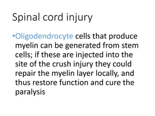 Spinal cord injury
•Oligodendrocyte cells that produce
myelin can be generated from stem
cells; if these are injected into the
site of the crush injury they could
repair the myelin layer locally, and
thus restore function and cure the
paralysis
 