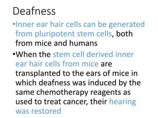 Deafness
•Inner ear hair cells can be generated
from pluripotent stem cells, both
from mice and humans
•When the stem cell derived inner
ear hair cells from mice are
transplanted to the ears of mice in
which deafness was induced by the
same chemotherapy reagents as
used to treat cancer, their hearing
was restored
 