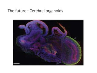 The future : Cerebral organoids
 