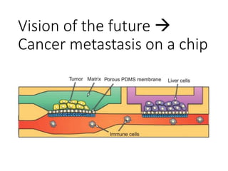 Vision of the future 
Cancer metastasis on a chip
 