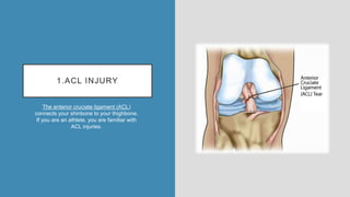 1.ACL INJURY
The anterior cruciate ligament (ACL)
connects your shinbone to your thighbone.
If you are an athlete, you are familiar with
ACL injuries.
 