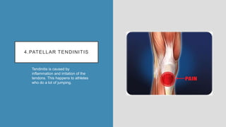 4.PATELLAR TENDINITIS
Tendinitis is caused by
inflammation and irritation of the
tendons. This happens to athletes
who do a lot of jumping.
 