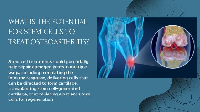 Stem Cell Therapy For Osteoarthritis | Dr. David Greene Arizona | PPTX