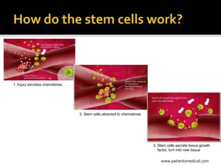 Stem Cell Therapy: The Future is Here! Find Out About the Clinical Trial and How You Can Be a Participant