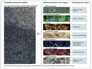 Stem cell therapy for spinal cord injuries | PPTX