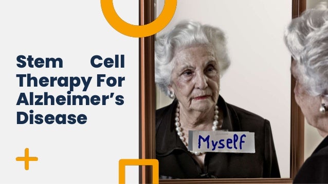 Stem Cell
Therapy For
Alzheimer’s
Disease
 